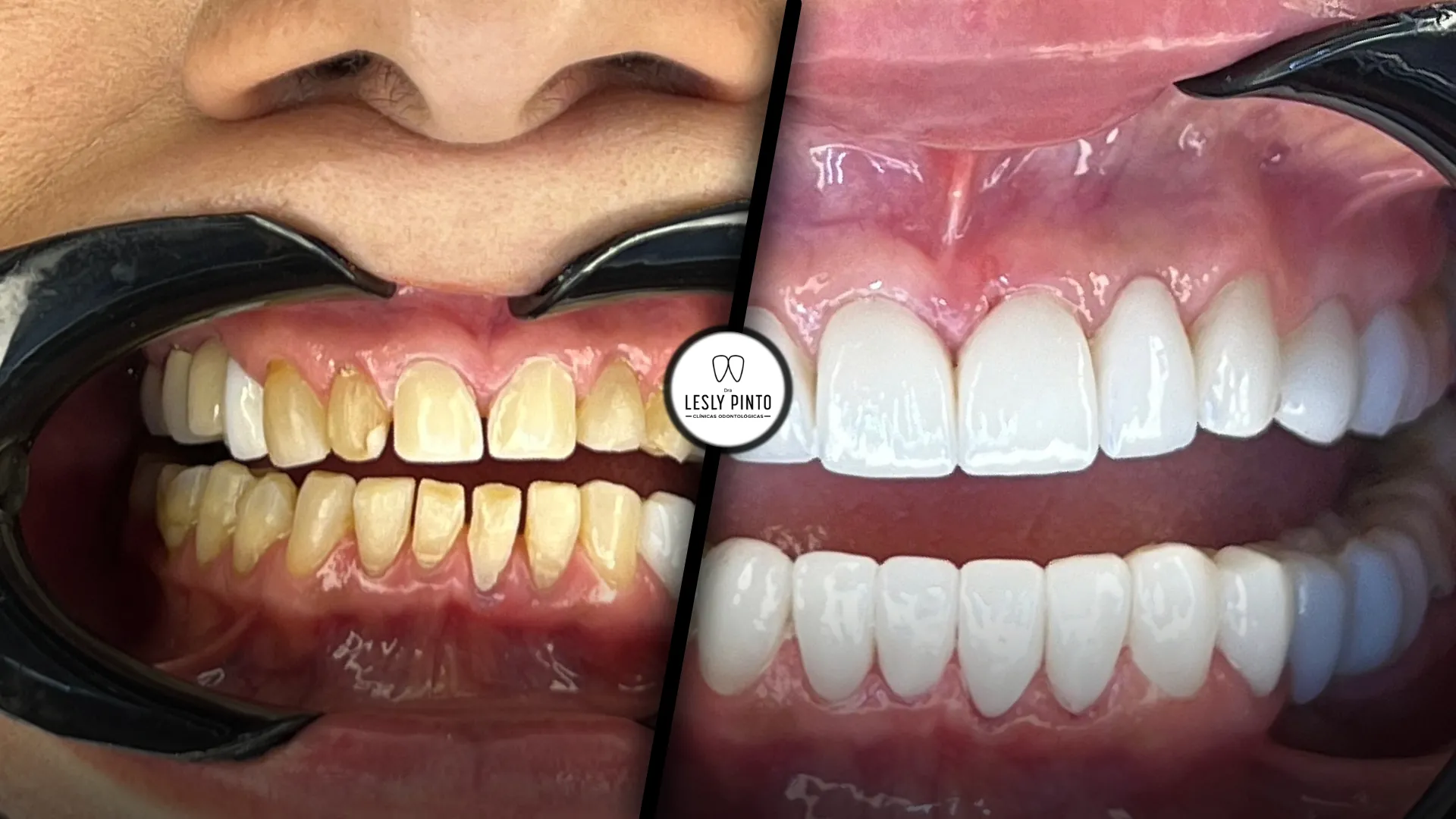 Paciente n2 - dra lesly pinto_11zon