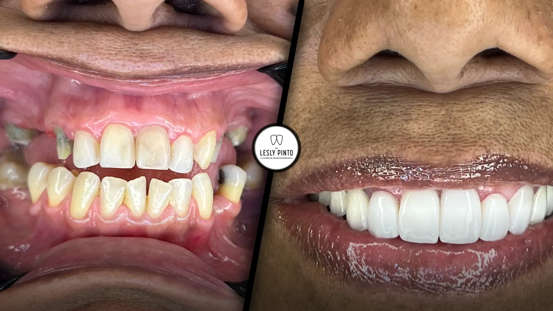 dental tourism in Colombia - patient