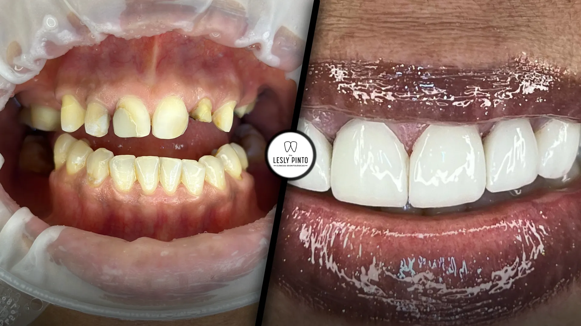 Paciente n4 - dra lesly pinto_11zon