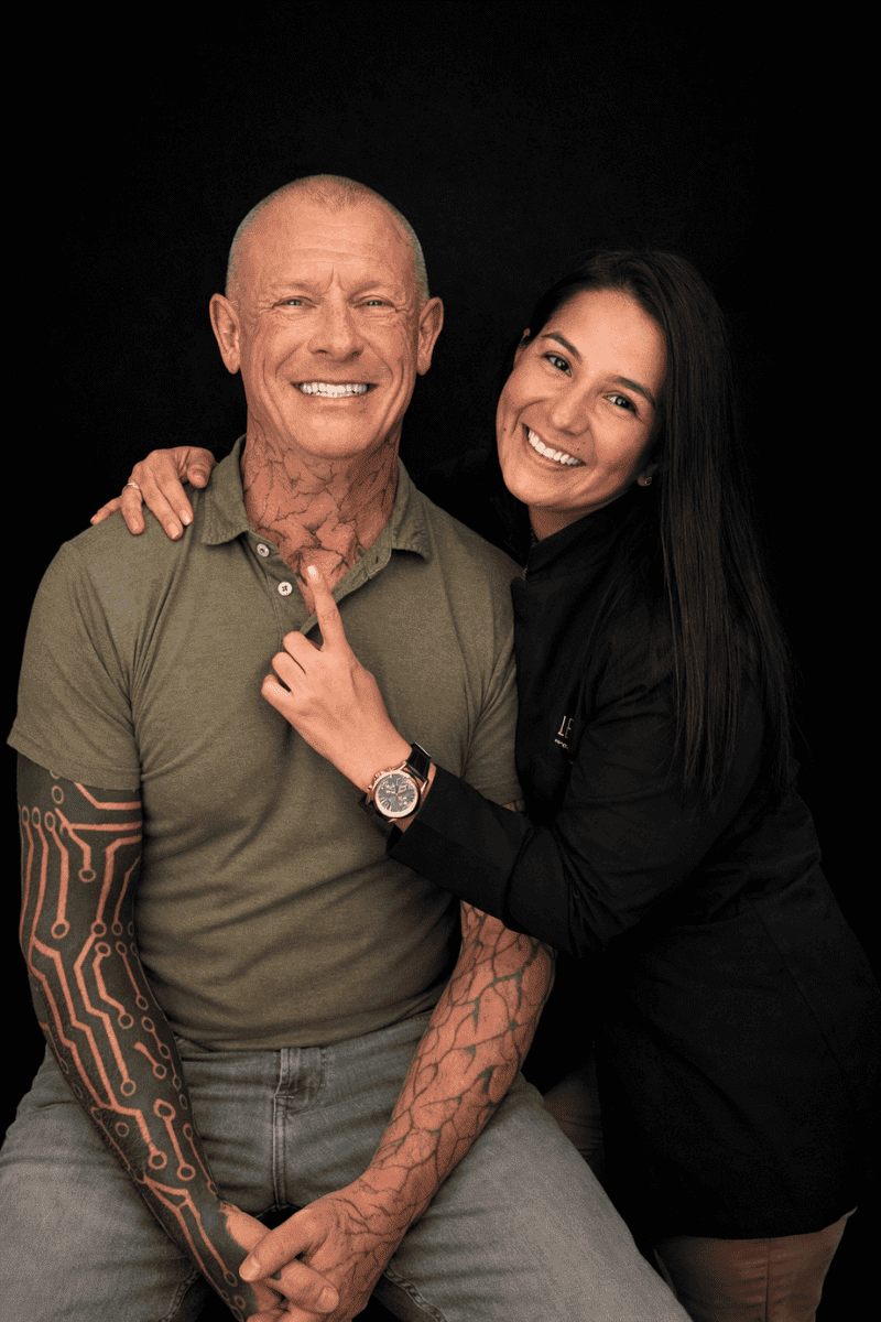 medellin-dental-veneers-patient-dr-lesly-pinto-3